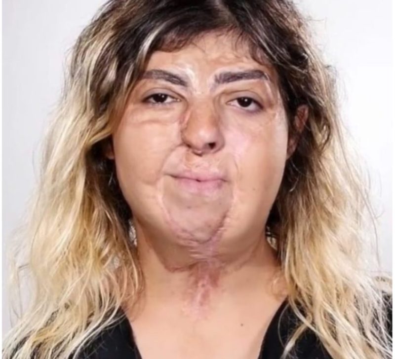 A skillful makeup artist helped this woman to regain her self-confidence by transforming her into a beauty
