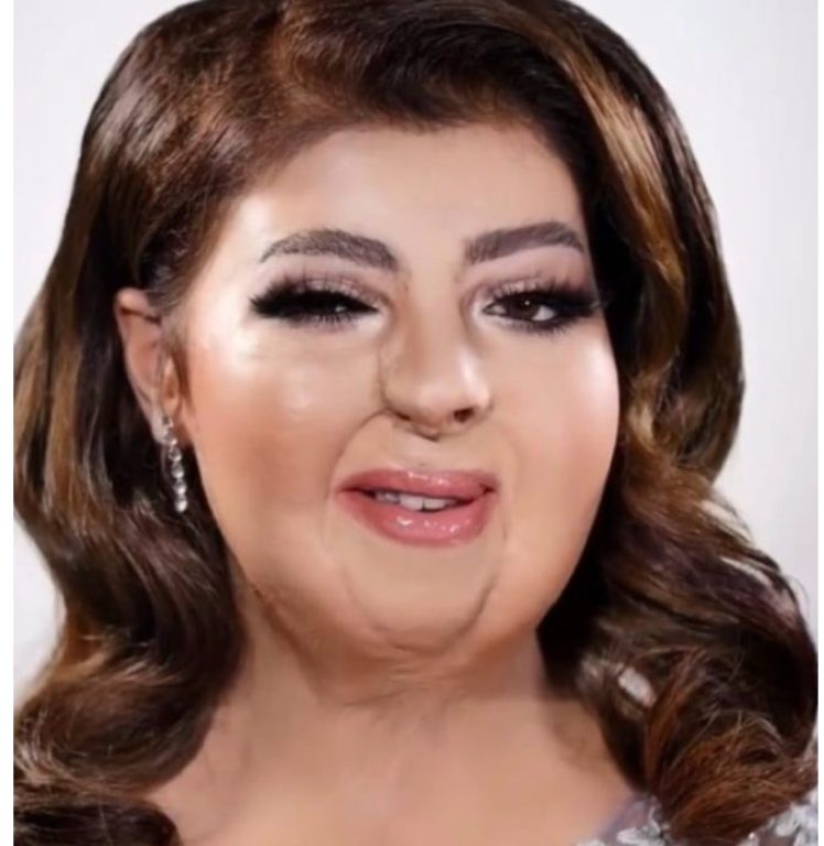 A skillful makeup artist helped this woman to regain her self-confidence by transforming her into a beauty