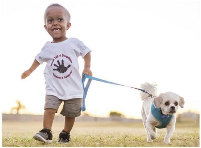 People laughed at the boy with dwarfism, but his faithful dog came to his aid: he is not a simple dog
