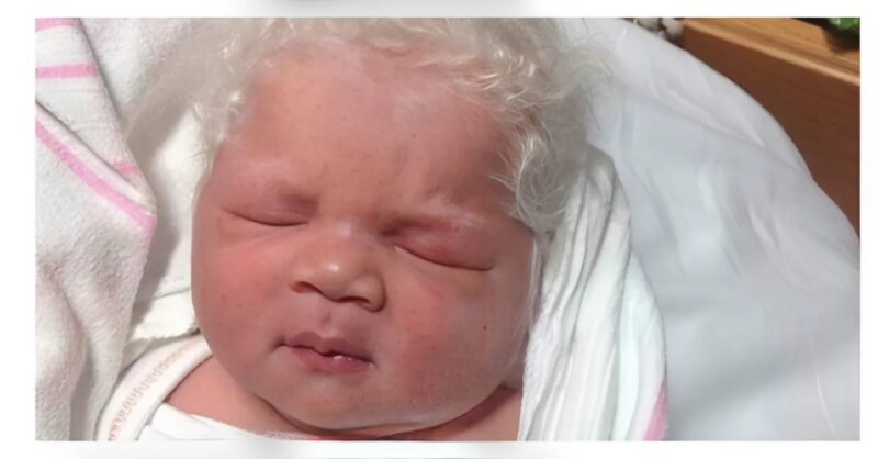 Something Mysterious! This Is The Look Of The Special Baby Born With White Hair
