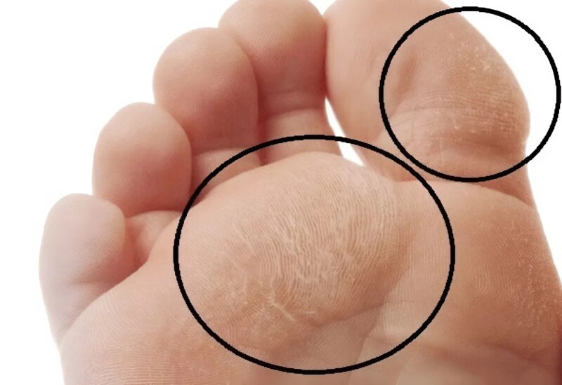 The skin on my grandmother’s legs was becoming increasingly dry and cracked