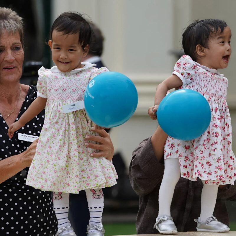 After a complex and risky operation doctors managed to separate these conjoined twin sisters