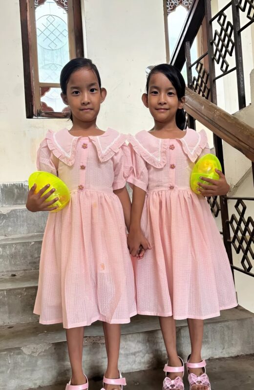 After a complex and risky operation doctors managed to separate these conjoined twin sisters