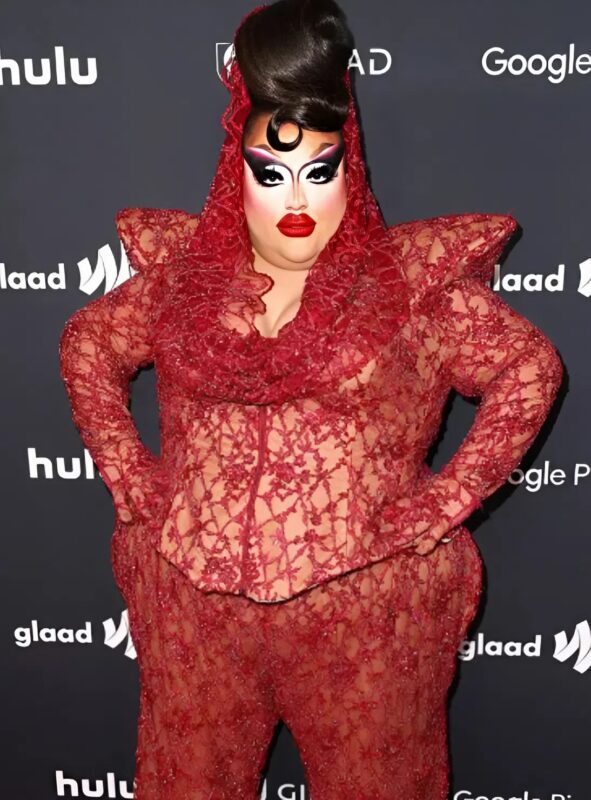 This girl is convinced that she is a true beauty and that all men go crazy over her: you will be shocked when you see what she looked like before!