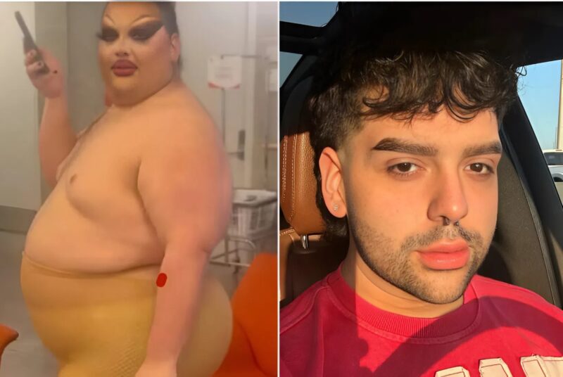 This girl is convinced that she is a true beauty and that all men go crazy over her: you will be shocked when you see what she looked like before!