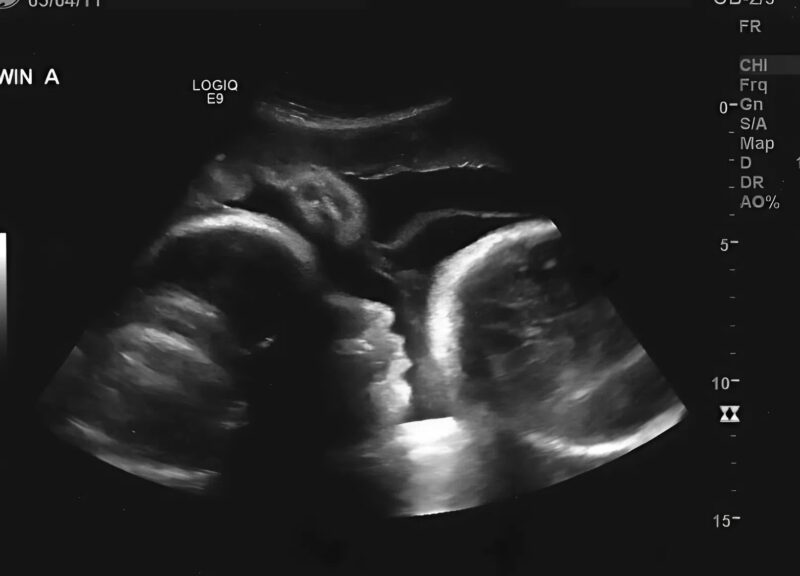 We were sure that my 66-year-old mother was suffering from some kind of illness, but after the examination, the ultrasound doctor whispered: “My God, I have never seen anything like this in my entire career…”